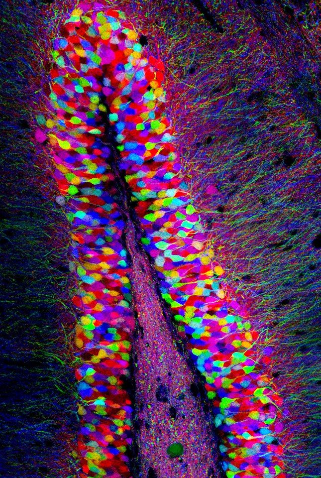 Cells under microscope
