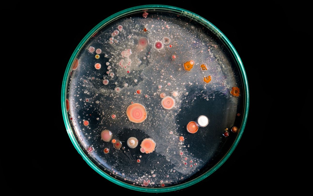 Petri dish in laboratory
